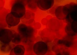 Медики назвали внешние признаки повышенного холестерина