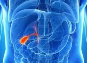 Врачи рассказали, как избежать камней в желчном пузыре