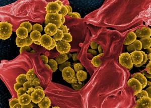 Ученые обнаружили опасные виды инфекции в останках древних рабов