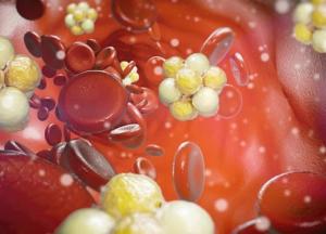 Врачи назвали 10 симптомов повышенного уровня холестерина