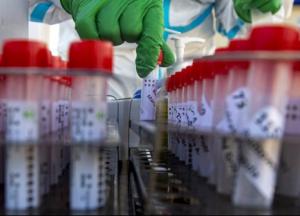 Появилась новая версия происхождения коронавируса