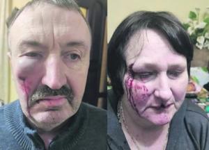 Под Киевом газовщик избил пенсионеров