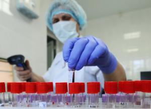 В Киеве тест на COVID-19 дал положительный результат