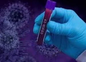 Ничего общего с гриппом: названы три фазы развития коронавируса