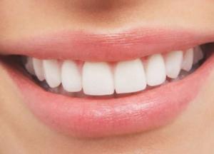 Приближение инсульта можно определить по состоянию зубов: вывод ученых