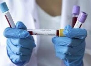 В Украине 617 новых случаев коронавируса