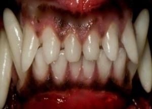 В Днепре собака разорвала ребенку лицо: фото