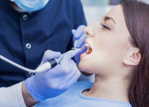 Ученые нашли новый способ защитить зубы от кариеса