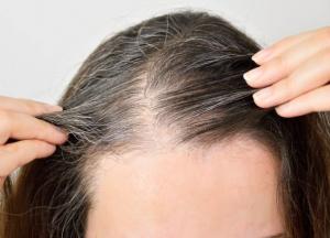 Ученые рассказали, почему люди рано седеют