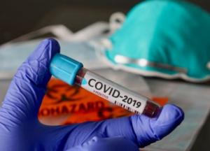 В Украине уже 315 тыс. случаев COVID-19, за сутки антирекорд - 6 719