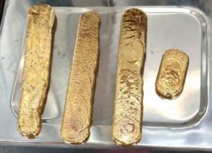 В Индии поймали контрабандиста с кило золота в заднем проходе