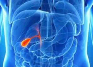 Названы запретные продукты при камнях в желчном пузыре 