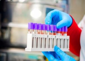 В Украине уже 178 тыс. случаев COVID-19, за сутки - 2 675