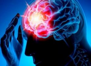 Медики назвали симптомы, предвещающие инсульт 