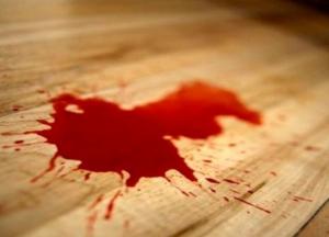 В Херсоне мужчина покончил с собой, отрезав голову электропилой