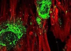 Ученые превратили стволовые клетки в кость с помощью звука