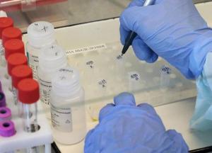 В Украине обнаружили минимум новых случаев коронавируса с начала года