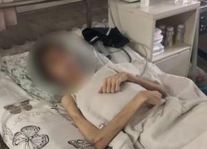 Житель Одессы морил сына голодом