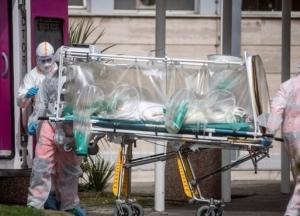 Украинские медики показали фото пораженных коронавирусом легких