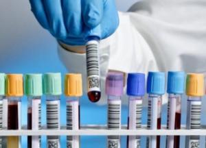 В Украине рекордное число новых случаев COVID-19