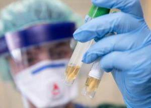 Ученые сделали важное заявление об антителах коронавируса: появится иммунитет