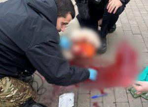 Бігла спускатися в метро: жінку з уламком в голові ушпиталили в тяжкому стані у Києві (фото, відео)
