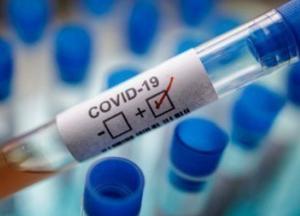 В Украине запустят новый вид тестирования на COVID-19