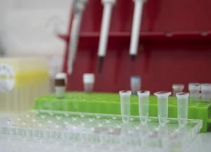 В Украине уже 156 тыс. случаев COVID-19, за сутки - 2 462