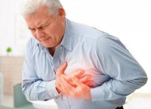 Медики назвали неожиданные признаки, предвещающие инфаркт