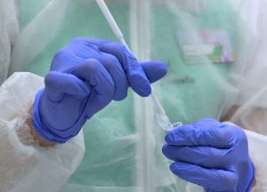 В Украине 610 новых случаев коронавируса