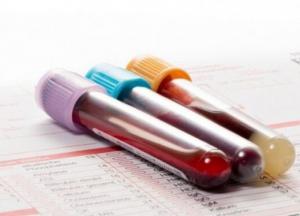 Названа болезнь, провоцирующая развитие рака