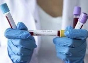 В Украине меняют стратегию по коронавирусу