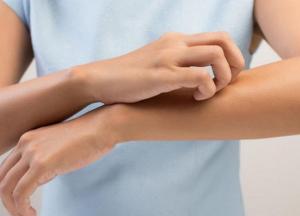 Кожный зуд: на какие расстройства в здоровье он может указывать 