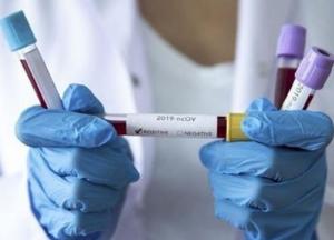 В Украине новый антирекорд: 10 842 случаев коронавируса за сутки