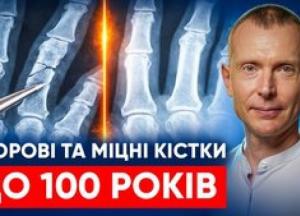 Чому кістки втрачають міцність після 35 років: зв'язок між стресом, рухом і здоров'ям