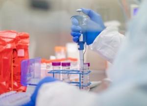 COVID-19 в Украине: за сутки новый антирекорд - 921 случаев