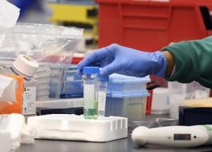 В Украине уже более 49 тыс. случаев COVID-19, за сутки - 543