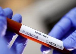 В Украине растет заболеваемость коронавирусом