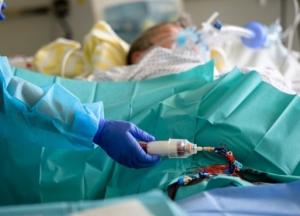 Тяжелый COVID удваивает шанс умереть в течение года – ученые