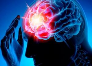 Медики назвали способы избежать инсульта