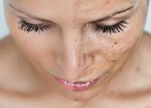 Медики рассказали, о каких проблемах со здоровьем говорит цвет кожи 