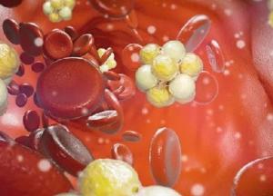 Медики рассказали, о чем может свидетельствовать покалывание в руках 