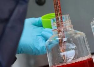 Врачи назвали неожиданный признак «тихого» рака у женщин