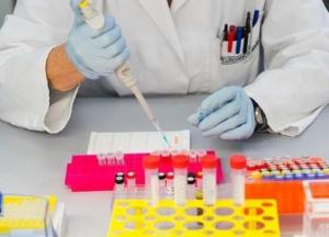 Впервые за 19 лет выявлена новая разновидность ВИЧ