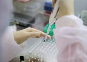 В Украине уже более 83 тыс. случаев COVID-19, за сутки - 1 158