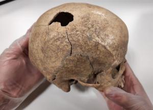 Археологи нашли останки мужчины, жившего 5 тыс. лет назад, и узнали тайну его смерти