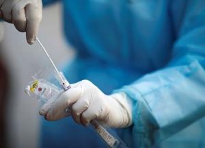 В Украине 5116 новых случаев коронавируса и втрое больше выздоровевших