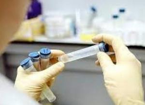 В Украине за сутки 1 785 новых COVID-случаев