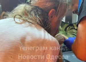 В Одессе на ребенка в ресторане упали двери