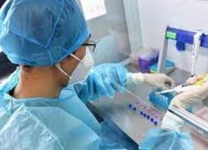 В Украине обнаружили 1188 новых случаев коронавируса